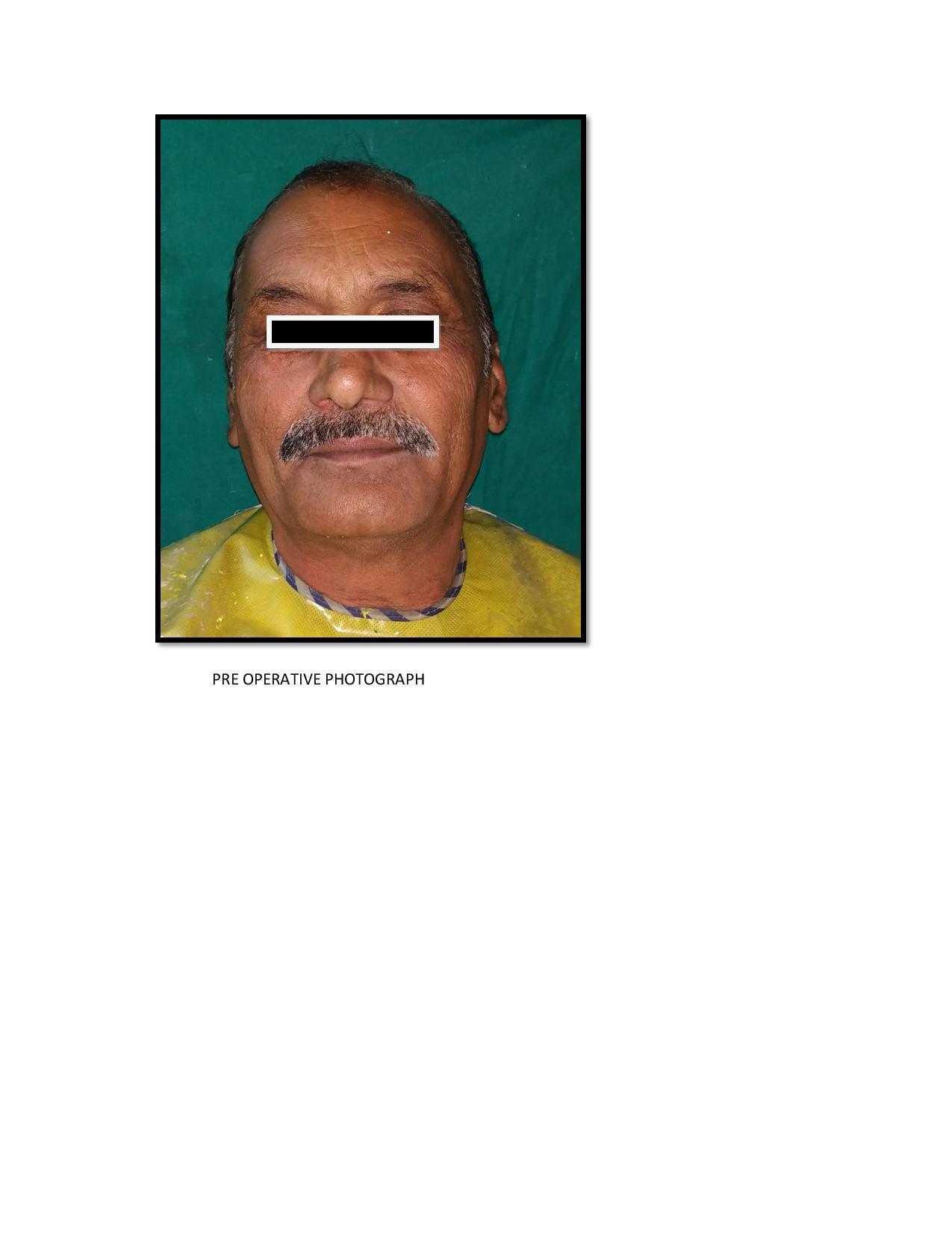 case report for the department of prosthodontics in the section of health informatics